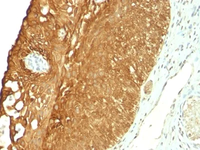 Immunohistochemistry (Formalin/PFA-fixed paraffin-embedded sections) - Anti-Cytokeratin 19 antibody [KRT19/800] - BSA and Azide free (AB212572)