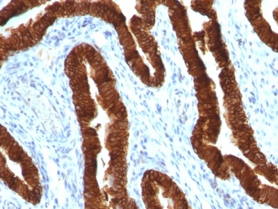 Immunohistochemistry (Formalin/PFA-fixed paraffin-embedded sections) - Anti-Cytokeratin 19 antibody [KRT19/800] - BSA and Azide free (AB212572)