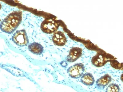 Immunohistochemistry (Formalin/PFA-fixed paraffin-embedded sections) - Anti-Cytokeratin 19 antibody [KRT19/800] - BSA and Azide free (AB212572)