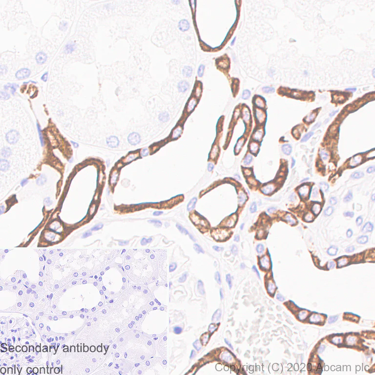 Immunohistochemistry (Formalin/PFA-fixed paraffin-embedded sections) - Anti-Cytokeratin 19 antibody [LP2K] - BSA and Azide free (AB255939)