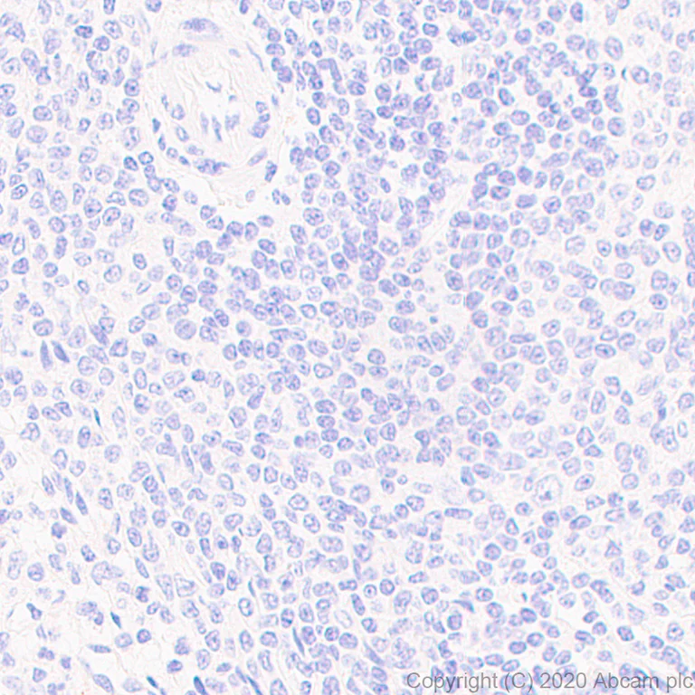 Immunohistochemistry (Formalin/PFA-fixed paraffin-embedded sections) - Anti-Cytokeratin 19 antibody [LP2K] - BSA and Azide free (AB255939)