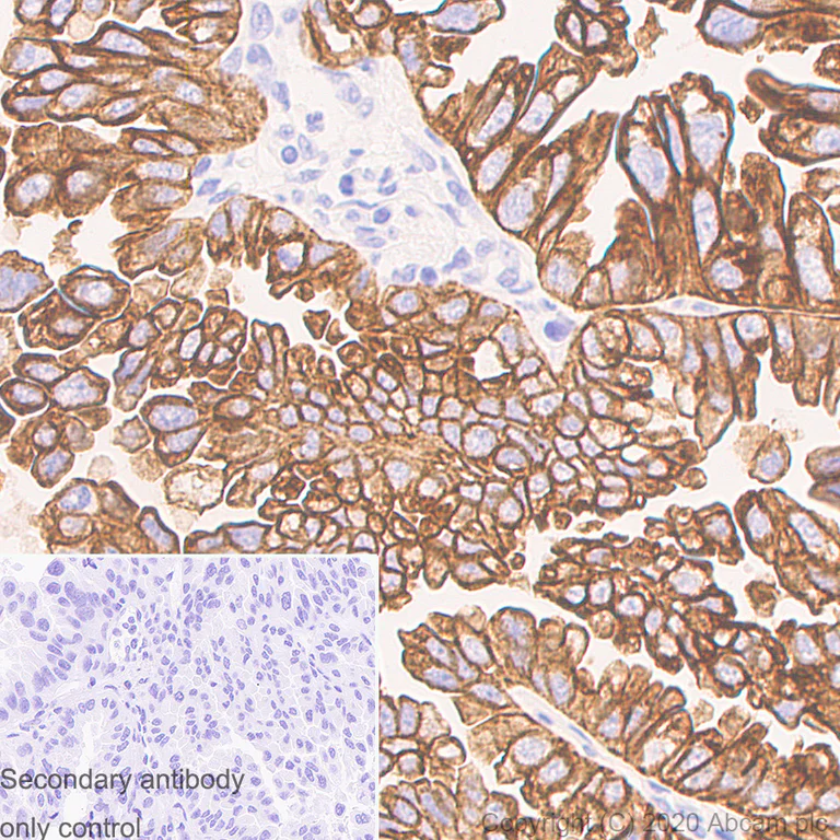 Immunohistochemistry (Formalin/PFA-fixed paraffin-embedded sections) - Anti-Cytokeratin 19 antibody [LP2K] - BSA and Azide free (AB255939)