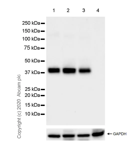 Western blot - Anti-Cytokeratin 19 antibody [LP2K] - BSA and Azide free (AB255939)