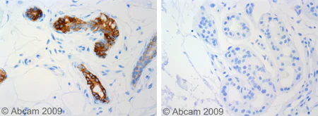 Immunohistochemistry (Formalin/PFA-fixed paraffin-embedded sections) - Anti-Cytokeratin 19 antibody [RCK108] (AB9221)