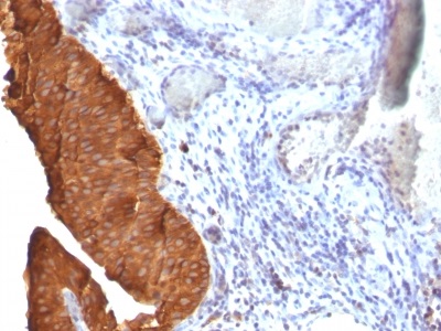 Immunohistochemistry (Formalin/PFA-fixed paraffin-embedded sections) - Anti-Cytokeratin 19 antibody [SPM561] (AB233917), expandable thumbnail