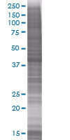 Cytokeratin 19 overexpression 293T lysate (whole cell)