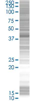 SDS-PAGE - Cytokeratin 19 overexpression 293T lysate (whole cell) (AB94061)