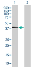 Western blot - Cytokeratin 19 overexpression 293T lysate (whole cell) (AB94061)