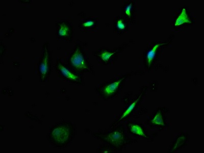 Immunocytochemistry/ Immunofluorescence - Anti-Cytokeratin 2 antibody (AB236751)