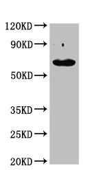 Western blot - Anti-Cytokeratin 2 antibody (AB236751)