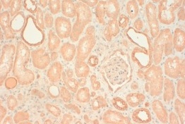 Immunohistochemistry (Formalin/PFA-fixed paraffin-embedded sections) - Anti-Cytokeratin 2 antibody [AE3] (AB16111), expandable thumbnail