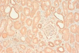 Immunohistochemistry (Formalin/PFA-fixed paraffin-embedded sections) - Anti-Cytokeratin 2 antibody [AE3] (AB16111)
