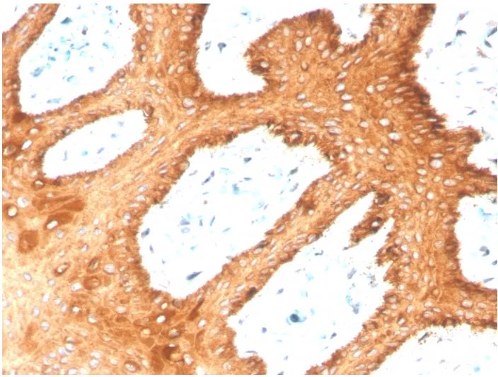 Immunohistochemistry (Formalin/PFA-fixed paraffin-embedded sections) - Anti-Cytokeratin 2 antibody [KRTH/4392R] - BSA and Azide free (AB273145)