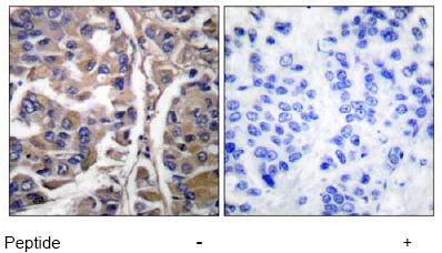 Immunohistochemistry (Formalin/PFA-fixed paraffin-embedded sections) - Anti-Cytokeratin 20 antibody (AB53120)