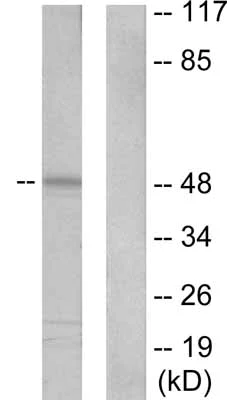 Western blot - Anti-Cytokeratin 20 antibody (AB53120)