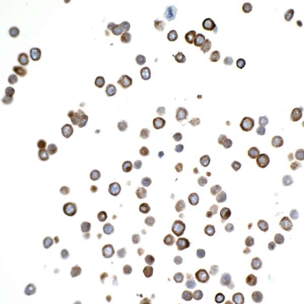 Immunocytochemistry - Anti-Cytokeratin 20 antibody [BLR105H] - BSA free (AB314073), expandable thumbnail