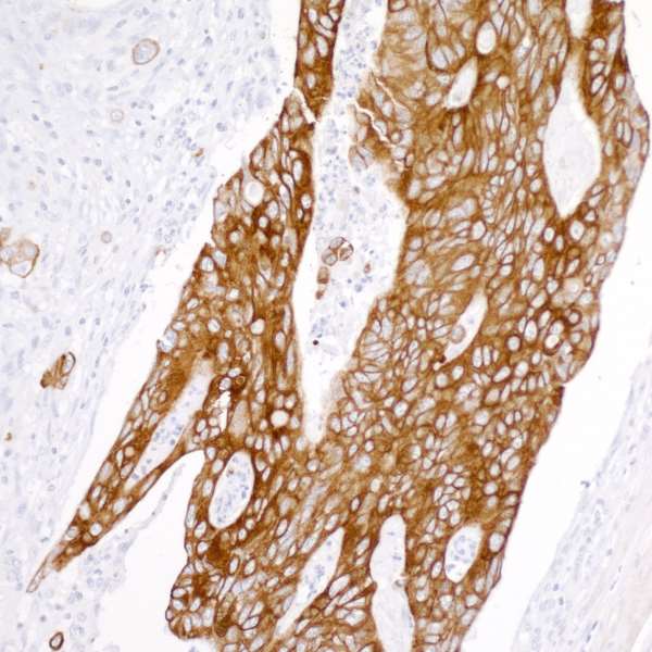 Immunohistochemistry (Formalin/PFA-fixed paraffin-embedded sections) - Anti-Cytokeratin 20 antibody [BLR105H] - BSA free (AB314073), expandable thumbnail