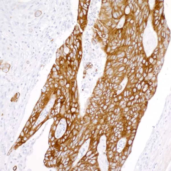 Immunohistochemistry (Formalin/PFA-fixed paraffin-embedded sections) - Anti-Cytokeratin 20 antibody [BLR105H] - BSA free (AB314073)