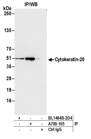 Immunoprecipitation - Anti-Cytokeratin 20 antibody [BLR105H] - BSA free (AB314073)