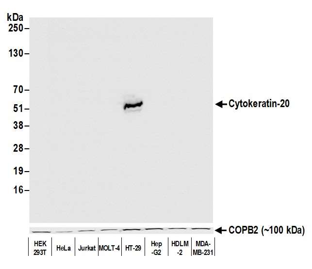 Western blot - Anti-Cytokeratin 20 antibody [BLR105H] - BSA free (AB314073), expandable thumbnail