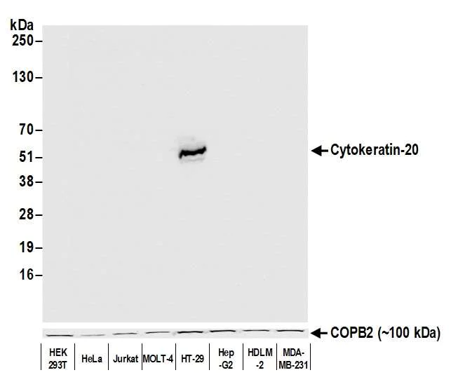 Western blot - Anti-Cytokeratin 20 antibody [BLR105H] - BSA free (AB314073)