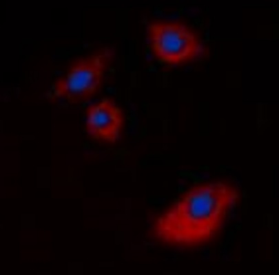 Immunocytochemistry/ Immunofluorescence - Anti-Cytokeratin 20 antibody - C-terminal (AB230524), expandable thumbnail