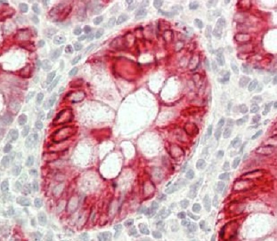 Immunohistochemistry (Formalin/PFA-fixed paraffin-embedded sections) - Anti-Cytokeratin 20 antibody - C-terminal (AB230524), expandable thumbnail