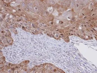 Immunohistochemistry (Formalin/PFA-fixed paraffin-embedded sections) - Anti-Cytokeratin 20 antibody - Cytoskeleton Marker (AB97511)