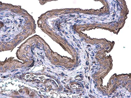 Immunohistochemistry (Formalin/PFA-fixed paraffin-embedded sections) - Anti-Cytokeratin 20 antibody - Cytoskeleton Marker (AB97511)