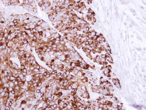 Immunohistochemistry (Formalin/PFA-fixed paraffin-embedded sections) - Anti-Cytokeratin 20 antibody - Cytoskeleton Marker (AB97511)