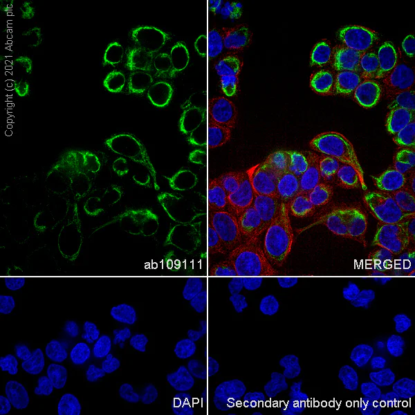 Immunocytochemistry/ Immunofluorescence - Anti-Cytokeratin 20 antibody [EPR1621(2)] - Cytoskeleton Marker (AB109111)
