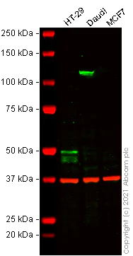 Western blot - Anti-Cytokeratin 20 antibody [EPR1621(2)] - Cytoskeleton Marker (AB109111)