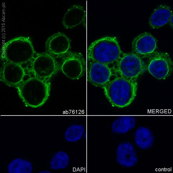 Immunocytochemistry/ Immunofluorescence - Anti-Cytokeratin 20 antibody [EPR1622Y] - BSA and Azide free (AB219589)