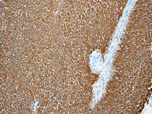 Immunohistochemistry (Formalin/PFA-fixed paraffin-embedded sections) - Anti-Cytokeratin 20 antibody [EPR1622Y] - BSA and Azide free (AB219589)