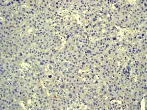Immunohistochemistry (Formalin/PFA-fixed paraffin-embedded sections) - Anti-Cytokeratin 20 antibody [EPR1622Y] - BSA and Azide free (AB219589)