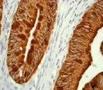 Immunohistochemistry (Formalin/PFA-fixed paraffin-embedded sections) - Anti-Cytokeratin 20 antibody [EPR1622Y] - BSA and Azide free (AB219589)