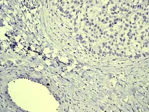 Immunohistochemistry (Formalin/PFA-fixed paraffin-embedded sections) - Anti-Cytokeratin 20 antibody [EPR1622Y] - BSA and Azide free (AB219589)
