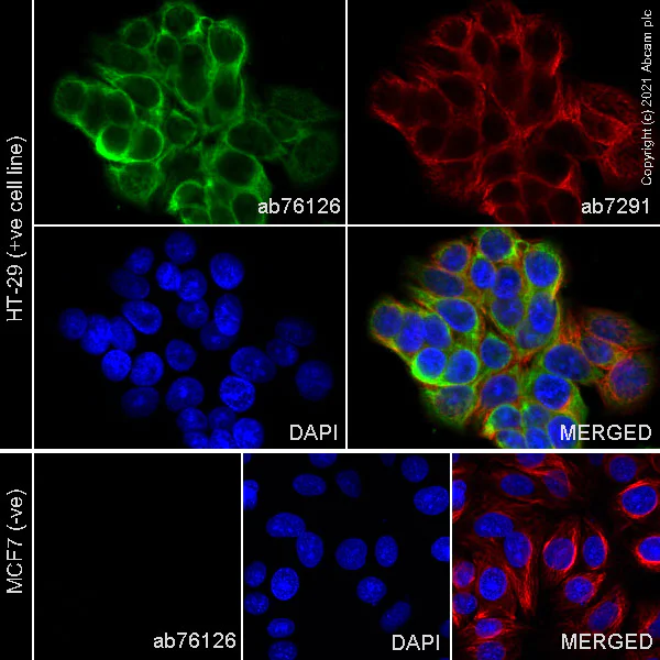 Immunocytochemistry/ Immunofluorescence - Anti-Cytokeratin 20 antibody [EPR1622Y] - Cytoskeleton Marker (AB76126)