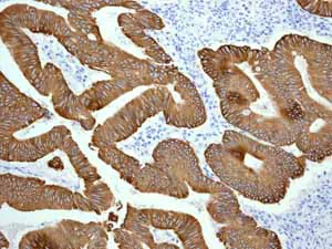 Immunohistochemistry (Formalin/PFA-fixed paraffin-embedded sections) - Anti-Cytokeratin 20 antibody [EPR1622Y] - Cytoskeleton Marker (AB76126)