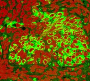 Immunohistochemistry (Formalin/PFA-fixed paraffin-embedded sections) - Anti-Cytokeratin 20 antibody [EPR1622Y] - Cytoskeleton Marker (AB76126)