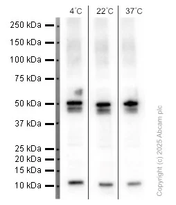 Western blot - Anti-Cytokeratin 20 antibody [EPR1622Y] - Cytoskeleton Marker (AB76126)