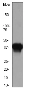 Western blot - Anti-Cytokeratin 20 antibody [EPR1622Y] - Cytoskeleton Marker (AB76126)