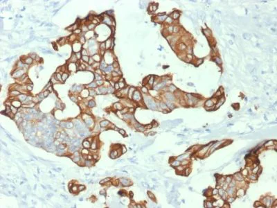 Immunohistochemistry (Formalin/PFA-fixed paraffin-embedded sections) - Anti-Cytokeratin 20 antibody [KRT20/1992] - BSA and Azide free (AB237881)