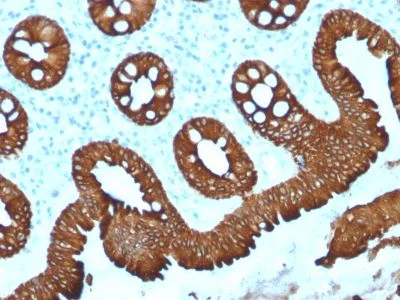 Immunohistochemistry (Formalin/PFA-fixed paraffin-embedded sections) - Anti-Cytokeratin 20 antibody [KRT20/1992] - BSA and Azide free (AB237881)