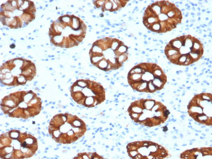 Immunohistochemistry (Formalin/PFA-fixed paraffin-embedded sections) - Anti-Cytokeratin 20 antibody [KRT20/1993] (AB268107), expandable thumbnail