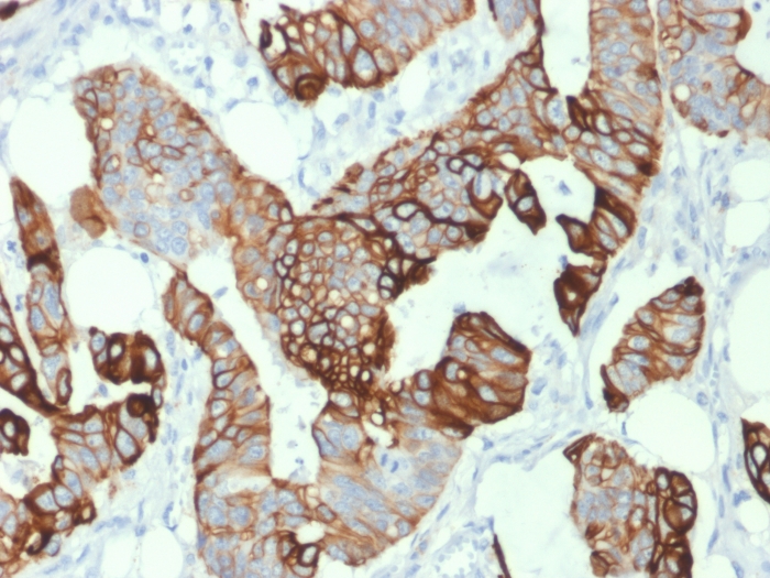 Immunohistochemistry (Formalin/PFA-fixed paraffin-embedded sections) - Anti-Cytokeratin 20 antibody [KRT20/1993] (AB268107), expandable thumbnail