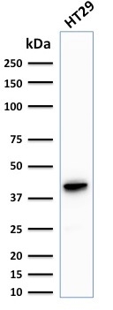 Western blot - Anti-Cytokeratin 20 antibody [KRT20/1993] (AB268107), expandable thumbnail