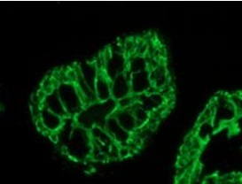 Immunocytochemistry/ Immunofluorescence - Anti-Cytokeratin 20 antibody [Ks20.8] (AB854), expandable thumbnail