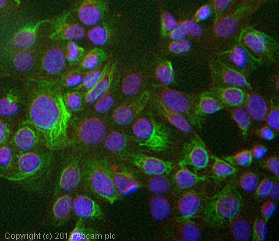 Immunocytochemistry/ Immunofluorescence - Anti-Cytokeratin 20 antibody [Ks20.8] (AB854), expandable thumbnail