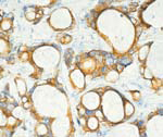 Immunohistochemistry (Formalin/PFA-fixed paraffin-embedded sections) - Anti-Cytokeratin 20 antibody [Ks20.8] (AB854), expandable thumbnail